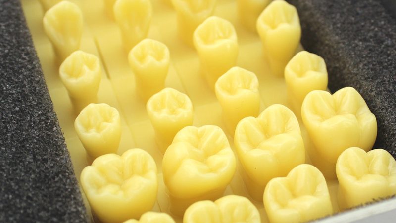 洗牙去牙结石，价格影响因素全解析